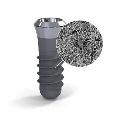 世界上最好的种植体品牌是哪个？全球五十大种植体品牌大全