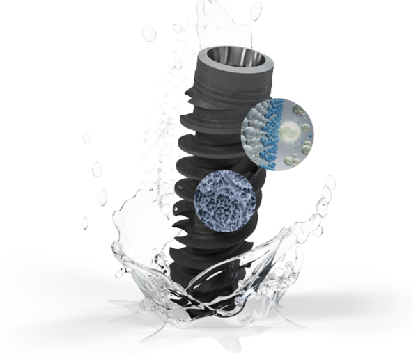 良心牙医五大忠告教你如何选择“种植体”？